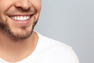 Відбілювання зубів